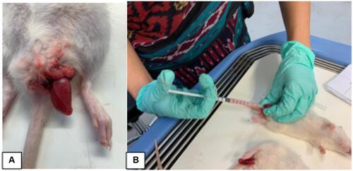 Figure 2 Testicular torsion model was simulated by twisting the left testicle for 720° counterclockwise (A), Intratesticular human ADSC injection (1x106 cells in 1000µL PBL solution) into the rete testis (1cc) (B).