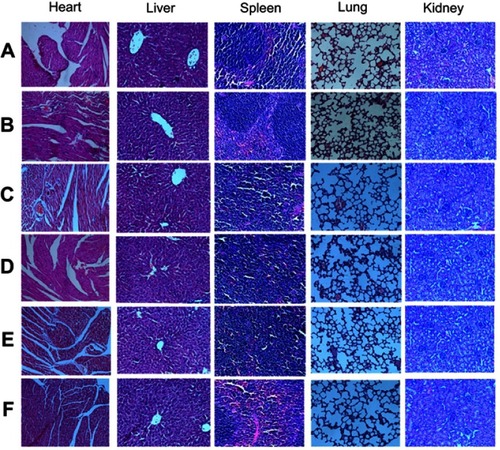 Figure 8 Organs morphology of mice from different groups. Hematoxylin-eosin staining of the heart, liver, spleen, lung, kidney in different groups. (A) Control group, (B) ES alone group, (C) GEM alone group, (D) ES/GEM group, (E) GEM/ES group, and (F) ES + GEM group.Abbreviations: ES, endostar; GEM, gemcitabine.