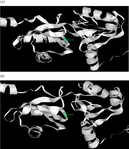 Figure 4. The position of amino acid alteration at 109 position within DAZL wild type (ASN109) and mutant type (THR109) protein. (A) Wild-type model showing asparagine at position 109 (ASN109) of DAZL protein constructed using multi-sources threader (MUSTER) and visualized by RasWin Molecular Graphics. (B) Mutant model showing threonine at position 109 (THR109) of DAZL protein constructed using MUSTER and visualized by RasWin Molecular Graphics.