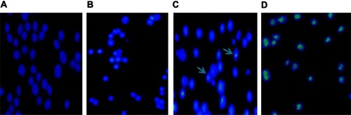 Figure 3 Cell apoptosis observed by Hoechst 33258 staining using a fluorescence microscope (200×). Values represent mean ± SD from three independent experiments. (A) Blank control group; (B) 0.4 μmol/L 5-Aza-CdR group; (C) 6.4 μmol/L 5-Aza-CdR group; (D) 102.4 μmol/L 5-Aza-CdR group.