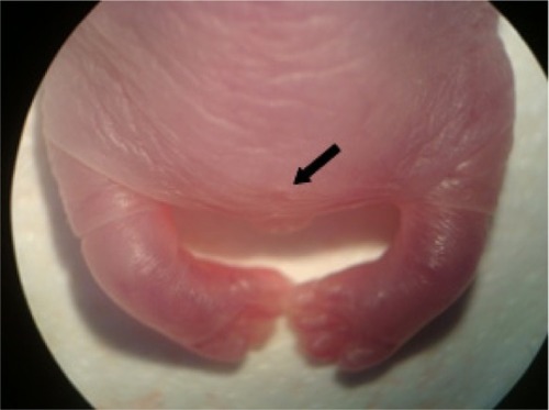 Figure 3 External alteration in the fetus from a pregnant rat treated with ZnOSM20(−) NPs at a dose of 100 mg/kg/day.Note: Hypoplasia tail (absent; arrow).Abbreviations: ZnOSM20(−), 20 nm negatively-charged ZnO; NPs, nanoparticles.