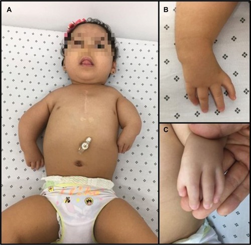 Figure 1 Morphological abnormalities.