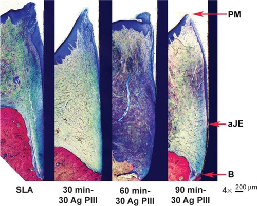Figure 6 Histological pictures demonstrating the landmarks which were used for the assessment of linear distance for the soft tissue.Notes: Control group (SLA), 30 min-30 Ag PIII treated group, 60 min-30 Ag PIII treated group, 90 min-30 Ag PIII treated group (from left to right). No significant difference was observed.Abbreviations: Ag-PIII, silver plasma immersion ion implantation; aJE, apical termination of the junctional epithelium; B, marginal bone crest; PM, peri-implant mucosa margin; SLA, titanium surfaces treated by sandblasting with large grit and acid etching procedure; 30 min-30 Ag PIII, titanium surfaces treated by first SLA procedure and then silver plasma immersion ion implantation at 30 kV for 30 minutes; 60 min-30 Ag PIII, titanium surfaces treated by first SLA procedure and then silver plasma immersion ion implantation at 30 kV for 60 minutes; 90 min- 30 Ag PIII, titanium surfaces treated by first SLA procedure and then silver plasma immersion ion implantation at 30 kV for 90 minutes.