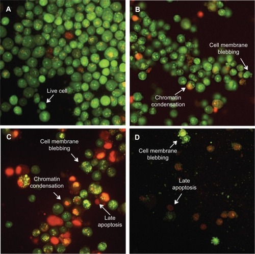 Figure 2 Boldine induces apoptosis in MDA-MB-231 cancer cells. (A) Untreated MDA-MB-231 cells demonstrated normal cellular structure. Early apoptosis features, including membrane blebbing and chromatin condensation, were observed after (B) 24 and (C) 48 hours of treatment with boldine. (D) Late apoptosis and necrosis were noticed after 72 hours of treatment with boldine (magnification, 200×).