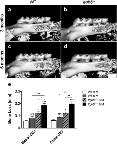 Figure 1. The micro-CT images and analysis of 3- and 6-month-old Itgb6−/− and WT mouse molar teeth.