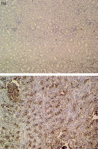 Figure 3.  3a: Light immunostaining for nitrotyrosine in kidney of a control goose, ×185. 3b: Moderate to strong immunostaining for nitrotyrosine in renal tubular epithelium of an EG-intoxicated goose. Also note that there is a strong immunoreactivity on erythrocytes, ×185.
