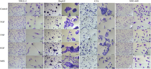 Figure 6 THLE-3, HepG2, C3A and SNU-449 cell morphology after incubation for 48 h in normal culture (control) and culture with the addition transforming growth factor, tumor necrosis factor, epidermal growth factor, and a growth factor cocktail (using May Grunwald-Giemsa stain). The scale bar is 200 µm on the left side and 50 µm on the right side.