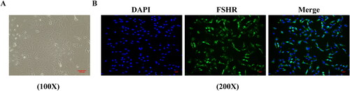 Figure 5. Extraction and identification of rats ovarian granulosa cells. (A) Primary rats ovarian granulosa cells morphology was observed (magnification, 100×). (B) FSHR antibody expression in ovarian granulosa cells was detected by immunofluorescence (magnification, 200×). FSHR: follicle-stimulating hormone receptor.