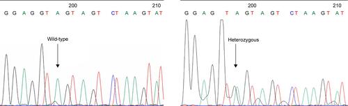 Figure S3 DNA sequencing analysis of a wild-type AA and a heterozygote A/G around the TLR4 Asp299Gly SNP area (forward primer).Abbreviation: SNP, single-nucleotide polymorphism.