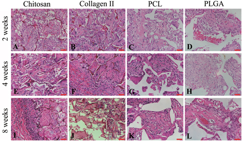 Figure 4. H&E staining of chitosan (A), (E), (I), collagen type II (B), (F), (J), PCL (C), (G), (K), and PLGA (D), (H), (L) showed cell morphology at 2 (A)–(D), 4 (E)–(H) and 8 (I)–(L) weeks. Scale bars = 50 μm.