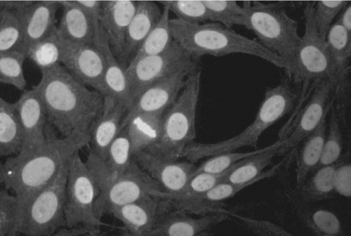 FIG. 2 Representative picture of mixed homogeneous/speckled pattern on positive ANA test from tremolite-instilled mouse. Serum samples were assayed by IIF on HEp-2000 cells at a 1:40 serum dilution.