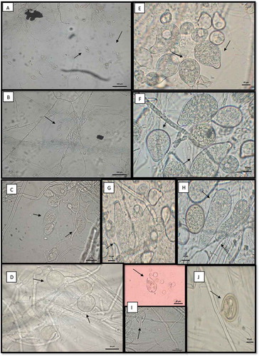 Fig. 3 (Colour online) Phytophthora tropicalis PtCa-14 observed by transmission electronic microscopy. (a) Sporangia showing sympodial with long pedicel and umbellate sporangiophores; (b) attachment of sporangiosphores is in close and simple sympodial arrangement; (c) sporangium typically papillate, ellipsoid; (d) chlamidosporas with base bulbous. Polymorphism sporangia; (e) sporangia limoniforme; (f) ellipsoid sporangia; (g) bi-papillate/tulbinate; (h) elongate; (i) release of zoospores with water; and (j) chlamydospore. Magnification: a, b, 20X; c, d, g, 40X; e, f, h, i, j, 100X