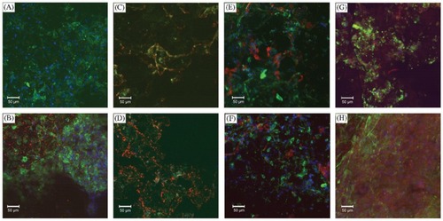Figure 3 Confocal microscopy images showing deposition of matrix proteins on PLLA scaffolds. Blue is Hoechst of nuclei, green in F-actin and red in specific stain: A) MSC+SM 1 week type II collagen; B) MSC+SOX−9+CM 1 week type II collagen; C) MSC+SM 4 weeks type II collagen; D) MSC+SOX−9+CM 4 weeks type II collagen; E) MSC+SM 1 week type I collagen; F) MSC+SOX−9+CM 1 week type I collagen; G) MSC+SM 1 week aggrecan; and H) MSC+SOX−9+CM 1 week aggrecan. Copyright © 2006. Reproduced with permission from CitationRichardson S, Curran J, Chen R, et al 2006. The differentiation of bone marrow mesenchymal stem cells into chondrocyte-like cells on poly-l-lactic acid (PLLA) scaffolds. Biomaterials, 27:4069–78.