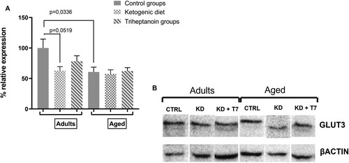 Figure 6. GLUT3 protein expression in the prefrontal lobe (A) was quantified by the intensity of the GLUT3 bands using the western blot method in triplicate. The b-actin bands normalized the GLUT3 expression in the same protein sample. Bars represent the mean of each group and horizontal lines represent SEM (n = 3 per group). (B) Representative immunostaining with anti-GLUT3 of prefrontal lobe slice.