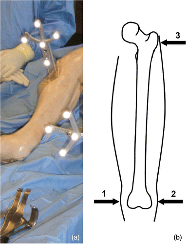 Figure 1. (a) Dynamic reference base fixation. (b) Field-of-view registration points.