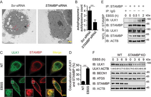 Figure 4. STAMBP positively regulates autophagy via stabilizing ULK1. (A-B) Electron microscopy observation (a) of ultra-structure of the cells. HeLa cells transfected with scramble or STAMBP siRNA are treated with rapamycin (250 nM) for 18 h before analysis. Arrows indicate autophagosomes or autolysosomes. Scale bar, 2 μm. Quantification (b) of autophagosomes and autolysosomes per cell after rapamycin treatment. (c-d) Confocal microscopy (c) and quantitative data (d) of HeLa cells at basal level or incubated in EBSS medium for 1 h. Scale bar, 20 μm. (e) co-IP and immunoassay of extracts of PBMCs treated with EBSS for various times (above lane). (f) Immunoassay of extracts of wild-type (WT) and STAMBP knockout (KO) HEK293 T cells cultured in EBSS medium for the various times (above lane). Data are representative of three independent biological experiments. Data in (a-d) are expressed as means ± SEM of three independent biological experiments (20 cells per sample). *p < 0.05, **p < 0.01, ***p < 0.001, ns, not significant. (two-tailed Student’s t-test)