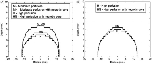 Figure 7. Contours of thermal damage zone (Ω = 4.6) for a heterogeneously perfused tumour for irradiation duration of (A) 105 s, and (B) 150 s. Irradiation intensity is 1 W/cm2 and GNR volume fraction is 0.001%. The blood perfusion rate was varied as a function of vascular stasis. Perfusion rates are as per Table 2.