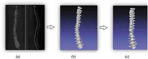 Figure 4. An illustrative view of the CT scan (a) and the segmented 3D model (b) compared in Meshlab with the morpho-realistic 3D model of Cadaver (c)