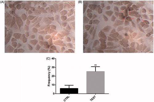 Figure 4. siRNA-mediated targeting of Snail-1 strongly sensitized Ej-138 cells by stimulation of apoptosis. (A) Untreated siRNA (control) with the In Situ Cell Death Detection Kit, POD. (B) Treated 60 pmol Snail-1 siRNA (test) with the In Situ Cell Death Detection Kit, POD. (C) Percentage of TUNEL-positive cells in control and test group. The results are expressed as mean ± SD (n = 3); **P < 0.001 versus control.