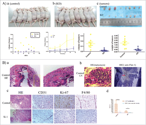 Figure 4. Flotillin-1 Contributes to LUAD Progression of Malignant Phenotype of LUAD in Vivo. (A) Xenograft model in nude mice. Representative images of tumor-bearing mice in silencing group, (a) control group, (b) siRNA knocked-down (KD) group, (c) images of the tumors, (d) the final tumor volumes of control side and KD side per mouse, (e) mean tumor volume of control group and KD group on the monitor days, (f) the final tumor volume of control group and KD group, (g) the final tumor weight of control group and KD group; (B) H&E and IHC staining demonstrated that knockdown of flotillin-1 inhibited the malignant phenotype of LUAD cells in vivo. (a) The picture of LUAD cells of control group infiltrated into the skin dermis of nude mouse. The red arrow and the yellow arrow respectively show the epidermis and LUAD cells. (b) Metastasis was showed in the lymph node of tumor-bearing mice. The white arrow of the left picture shows the metastatic LUAD cells. The red arrow of the right picture shows the Flot-1-positive cells. (c) The representative pictures and (d) quantification column chart as indicated by the expression of CD31, Ki67, and F4/80-positive cells. Each bar represents the mean standard deviation of 3 independent experiments.*, P<0.05; **, P<0.01.