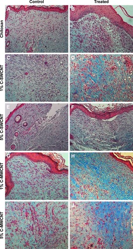 Figure 5 Treatment with 5% C-MWCNTs best improved the fibrotic processes in healing wounds.Notes: Masson’s trichrome stain for sectioned full-thickness skin tissue samples collected from the site of the healing wounds at the end of the 9-day treatment course. The bluish-green color represents the stained collagen. Magnification 100×. (A, C, E, G, I) Internal controls of the corresponding treatment conditions; (B) following treatment with chitosan; (D) following treatment with 1% C-SWCNTs; (F) following treatment with 5% C-SWCNTs; (H) following treatment with 1% C-MWCNTs; (J) following treatment with 5% C-MWCNTs.Abbreviations: C-SWCNT, chitosan–single-wall carbon nanotube; C-MWCNT, chitosan–multi-wall carbon nanotube.