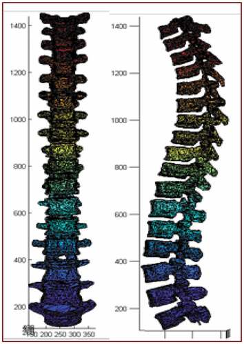 Figure 3. Modified feature-based spine model