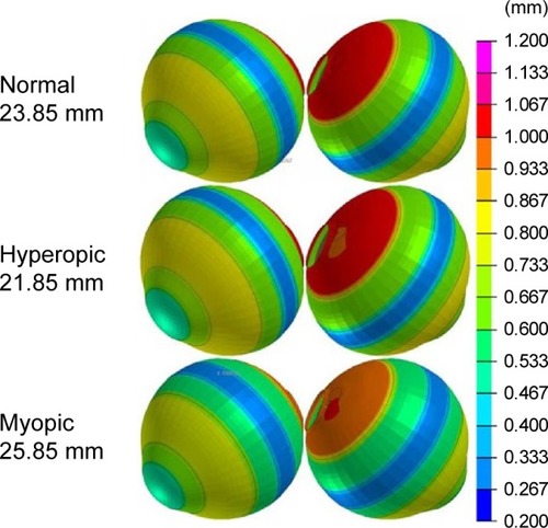 Figure 3 The thickness of the eye wall (mm) is depicted from cold to warm colors.