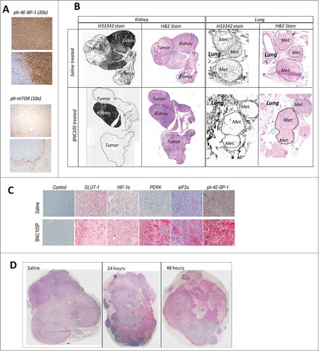 Figure 3. Molecular and cellular events associated with BNC105 induced vascular disruption and tumor recovery. (A) IHC showing DAB detection of ph-mTOR and ph-4E-BP-1 in the viable rim of Caki-1 tumors 24 hours post 32 mg/kg BNC105P. Upper panel of each indicates treatment with saline only. (B) H33342 fluorescent images of Renca orthotopic tumors (composite images) and metastatic lung lesions (Met.). Slides post-stained with H&E. (C) IHC showing Fast Red detection in representative viable tumor sections 24 hours post 32 mg/kg BNC105P or saline treatment. Control indicates detection antibody used only. (D) IHC showing Fast Red detection of secreted VEGF-A in Renca orthotopic tumors (composite image) 24 and 48 hours post 32 mg/kg BNC105P.