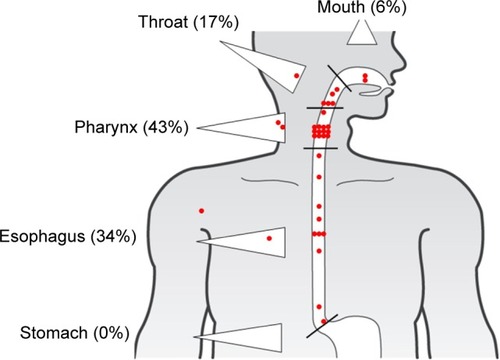 Figure 2 Localization of patient’s swallowing difficulties with medication intake (35 marks provided by 19 patients).