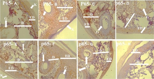 Figure 3 Photomicrograph of the skin of the experimental animals in Groups A–H demonstrating the skin using the p65 immunohistochemistry technique (p65 A-H). More cells in the groups B, D, F, and G expressed p65 which was used as an inflammation marker.