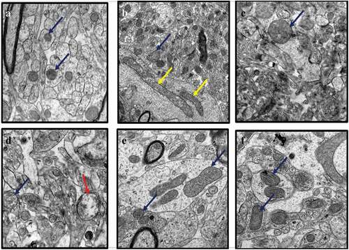 Figure 2. TEM images of rat’s brains showing mitochondrial aberrations in CUMS rats and those co-administered with fluoxetine and CA. a) Control group of rats showing normal mitochondria (blue arrow) with dense matrix, b) CUMS rats showing elongated and burst mitochondria (yellow arrow), c) fluoxetine group of rats showing normal mitochondria like those of the control group of rats, d) CA 200 group of rats showing normal mitochondria (blue arrow) and vacuolated mitochondria (red arrow), and e-f) CA 400 and 800 groups of rats, showing normal mitochondria.