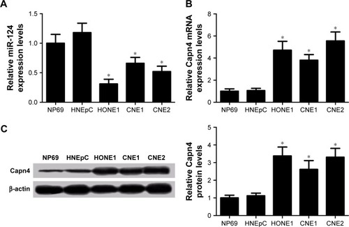 Figure 1 The level of microRNA-124 (miR-124) was downregulated and Capn4 expression was upregulated in NPC cell lines (HONE1, CNE1, and CNE2) compared with human nasal epithelial cell line (HNEpC) or immortalized nasopharyngeal epithelial cell line (NP69).