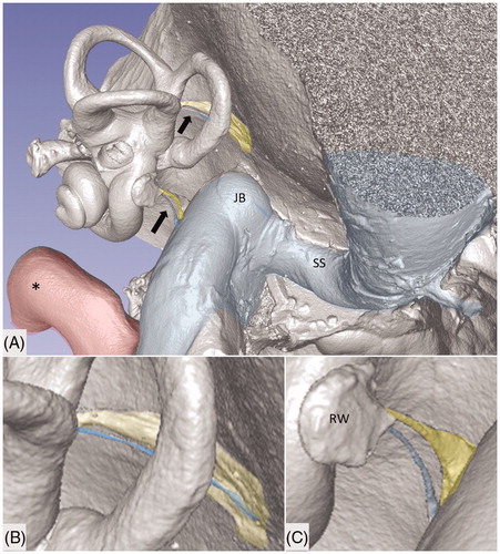 Figure 1. Micro-CT and volume rendering of a plastic corrosion cast of a left human temporal bone. The VA and CA (yellow) with their accessory canals (blue) are seen (arrows). They drain blood from the inner ear and are shown in higher magnification in B and C. *carotid artery; JB: jugular bulb; RW: round window; SS: sigmoid sinus.