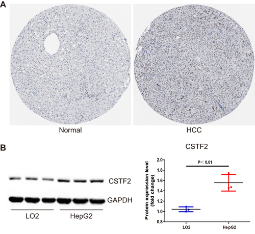 Figure 2 CSTF2 protein was upregulated in HCC. (A) The protein expression of CSTF2 in HCC based on the HPA database. (B) The protein expression of CSTF2 in cell lines.
