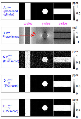 Figure 1 Numerical simulation results of cylindrical magnetic susceptibility reconstructions. The 3D cylindrical volumes are displayed with three orthogonal central slices (x-slice, y-slice, and z-slice). (A) A predefined cylindrical susceptibility map (ground truth). (B) T2* phase image (calculated by T2*MRI simulation). Note that the main field B0 (marked in red arrow) is perpendicular to the cylinder axis; (C) χ reconstruction by filter truncation solver (‘trunc recon’) (Equation 5 with threshold ε0=0.12); (D) χ reconstruction by TV-regularized 3-subproblem Bregman iteration solver (‘TV3 recon’);Citation13 (E) χ reconstruction by TV-regularized 2-subproblem Bregman iteration solver (‘TV2 recon’) (Equation 12). Both TV3 recon and TV2 recon were performed with the same settings: λ=50 and 15 iterations.
