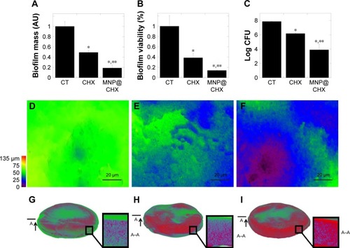 Figure 4 Chlorhexidine in free and immobilized form activity against fungal biofilm formation on the surface of dental filling.Notes: Reduction of biofilm mass (A) and cell viability (B, C) after addition of CHX and MNP@CHX at 20 μg/mL. Panels (E and F) represent effective restriction of biofilm formation during 72 h on the surface of dental fillings after addition of chlorhexidine and MNP@CHX at 20 μg/mL compared to control (D). X-ray microtomography 3D images and cross sections of dental fillings with mature fungal biofilm before (G) and after treatment by chlorhexidine (H) and MNP@CHX (I) at 20 μg/mL. *Statistically significant (P≤0.05) activity tested agents compared to untreated control (CT). **Statistically significant (P≤0.05) activity of magnetic nanoparticles coated by chlorhexidine compared to nonimmobilized drugs. Red color indicates dental filling; green color shows the presence of fungal biofilm. The “A”s, arrows, and line segments indicate the place of cutting of material (technical drawing); the “A–A”s indicate cross-section of material.Abbreviations: CFU, colony forming units; CHX, chlorhexidine; MNP@CHX, magnetic nanoparticles functionalized by chlorhexidine.