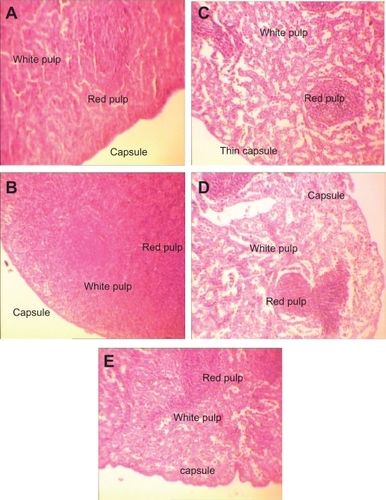 Figure 6 H&E stained spleen sections in subchronic toxicity study (× 40). A) Normal spleen in control group. B) Thin red capsule with inflammation and white pulp hypertrophy in AgNO3 group; C) Thin capsules with inflammation, accumulation of red blood cells (RBC), and white pulp atrophy in low-dose nanosilver group; D) Thin capsules with inflammation, accumulation of RBC, and white pulp atrophy in medium-dose nanosilver group; E) The highest levels of red pulp inflammation, white pulp atrophy, and thinnest capsule in high-dose nanosilver group.