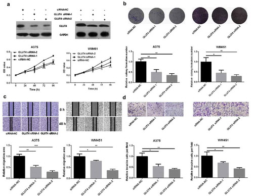 Figure 4. Knockdown of GLUT4 reduces proliferation and metastasis of melanoma cells. (A) Western Blot confirmed that GLUT4 siRNA can significantly knockdown the expression of GLUT4. (B) MTT assay showed decreased proliferative ability in GLUT4 siRNA-transfected A375 and GLUT4 siRNA-transfected WM451 cells than that in NC cells. (C-D) Scratch and Transwell invasion experiments showed inhibited migration and invasion ability in A375 and WM451 cells after down regulation of GLUT4. ***P <0.001, **P < 0.01, *P < 0.05.