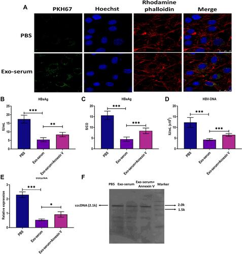 Figure 2 The antiviral effect of exosomes derived from the serum of CHB patients. (A) Fluorescence staining assay for visualizing the internalization of exosomes derived from the serum of CHB patients at 48 weeks after receiving daily TAF treatment (25 mg) (Exo-serum) in HepAD38 cells. Exo-serum was labeled with fluorescent dye PKH67 (green). The nuclei were labeled with fluorescent dye Hoechst (blue). The cytoskeleton was labeled with fluorescent dye rhodamine phalloidin (red). Scale bar = 25 μm. (B) The HBsAg level in the culture supernatants of HepAD38 cells treated with Exo-serum (10 μg/mL) or Exo-serum (10 μg/mL) plus Annexin V (1 µg/mL) for 48 h. (C) The HBeAg level in the culture supernatants of HepAD38 cells treated with Exo-serum (10 μg/mL) or Exo-serum (10 μg/mL) plus Annexin V (1 µg/mL) for 48 h. (D) The HBV DNA level in the culture supernatants of HepAD38 cells treated with Exo-serum (10 μg/mL) or Exo-serum (10 μg/mL) plus Annexin V (1 µg/mL) for 48 h. (E) The intracellular HBV cccDNA level of HepAD38 cells treated with Exo-serum (10 μg/mL) or Exo-serum (10 μg/mL) plus Annexin V (1 µg/mL) for 48 h. (F) The intracellular HBV cccDNA level of HepAD38 cells treated with Exo-serum (10 μg/mL) or Exo-serum (10 μg/mL) plus Annexin V (1 µg/mL) for 48 h, as detected by southern blot assay. *p < 0.05, **p < 0.01, ***p < 0.001.