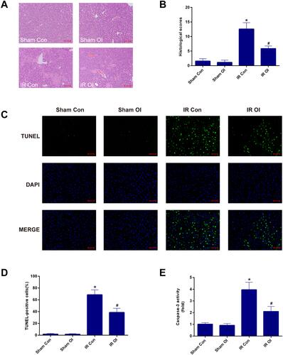 Figure 2 Itaconate pretreatment attenuates the liver IR injury in mice. (A) Representative HE-stained photographs (200×) of liver sections were selected from four groups. (B) Histopathological score of hepatic damage was calculated. (C) Representative photographs (200×) of liver sections stained by TUNEL were presented from four groups. (D) TUNEL-positive cells were counted as described in Materials and methods. (E) Caspase-3 activity in the liver tissues was assessed by specific assay kit. Data are showed as mean ± SD of 5–7 animals per group. *Significant difference from the Sham Con group, P < 0.05. #Significant difference from the IR Con group, P < 0.05. Bar: 100 µm.