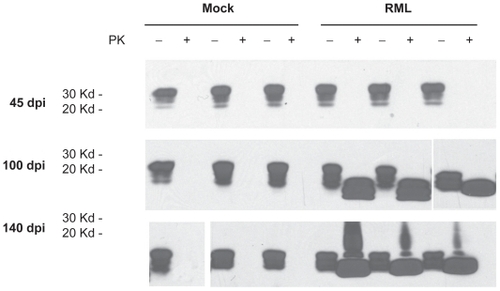 Figure 1 Prion protein and proteinase K resistant prion protein accumulation in brains from mock and RML-Chandler scrapie-infected mice at 45, 100, and 140 days post-infection. Western blot analysis showing prion protein antibody staining (SAF83) of protein extracts that were untreated or treated with proteinase K.