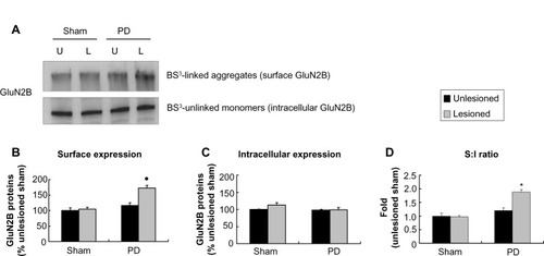 Figure 6 Effect of 6-OHDA lesions on GluN2B receptor expression in surface and intracellular pools of rat striatum.
