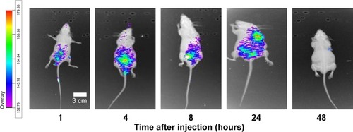Figure 5 In vivo images of tumor-bearing mice after intravenous injection of DiR-micelles (n=3).Abbreviation: DiR, 1,1′-dioctadecyl-3,3,3′,3′-tetramethyl indotricarbocyanine iodide.