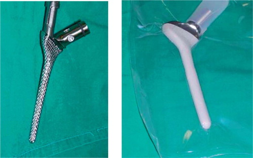 Figure 5. The custom-made femoral rasp and implant.
