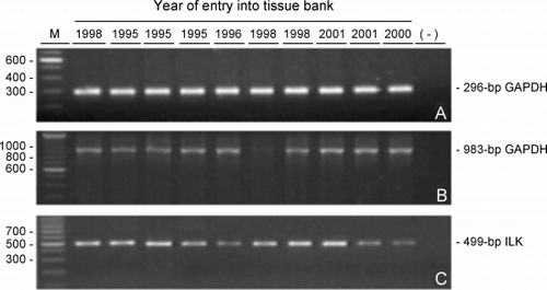 Figure 5. RNA integrity versus tissue storage time. Ethidium bromide‐stained agarose gels of (A) the 296‐bp glyceraldehyde 3‐phosphate dehydrogenase (GAPDH), (B) 983‐bp GAPDH and (C) 499‐bp integrin‐linked kinase (ILK) RT‐PCR products amplified from equal amounts of RNA extracted from frozen lung tissues that were selected to span entry dates into the tissue bank between 1995 to 2001. (−) negative control where cDNA was replaced with distilled water in the PCR reactions; (M) size markers with the corresponding bp sizes indicated at the left of the gels.