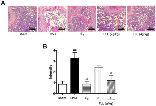 Figure 4. FLL reduces fat content in the bone marrow of OVX mice. (A) H&E staining showed that the white vacuoles in bone marrow increased in the OVX group, while estrogen and FLL significantly reduced the area of white vacuoles after eight weeks of treatment in OVX mice. (B) The white vacuoles were measured quantitatively and data are shown below. ##p < 0.01 compared with sham; **p < 0.01 compared with OVX (n = 3).