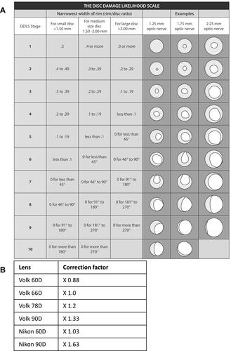 Figure 1 (A) Spaeth’s DDLS staging system stratified according to the optic disc sizes. Table reproduced from the Scottish Intercollegiate Guidelines Network (SIGN). Edinburgh: SIGN; 2015. (SIGN publication no. 144). [cited March 2015]. Available from URL: http://www.sign.ac.uk. These guidelines are licensed under the Creative Commons Attribution-Noncommercial-NoDerivatives 4.0 International Licence.Citation27 (B) Table of magnification correction factors to accurately calculate disc size.