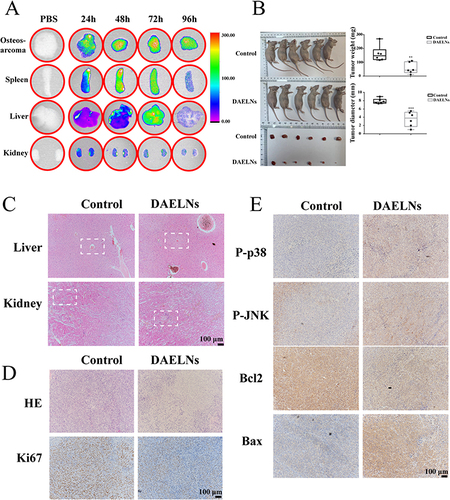 Figure 5 DAELNs inhibits tumor growth of osteosarcoma cells in vivo. (A) The bio-distribution of DiD-labeled DAELNs in tumor, spleen, liver and kidney tissues from the osteosarcoma mouse model by in vivo imaging system. (B) The tumor growth of osteosarcoma mouse model by treat with DAELNs. Data are shown as the mean ± SEM. **P < 0.01, and ***P < 0.001. (C) The toxicity of kidney and liver by HE staining. The white dotted square means the hepatic lobule of liver and the glomerulus of the kidney. (D and E) The H&E staining and IHC staining of tumor tissues stained with Ki67, P-p38, P-JNK, Bcl2, and Bax.