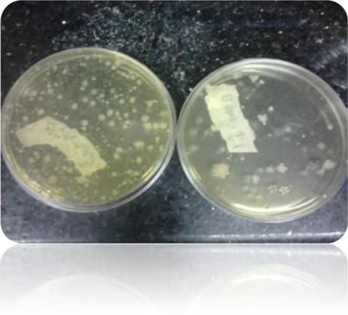 Figure 9 The number of colonies in the control sample immediately after inoculation (right) and 24 hours after inoculation (left).