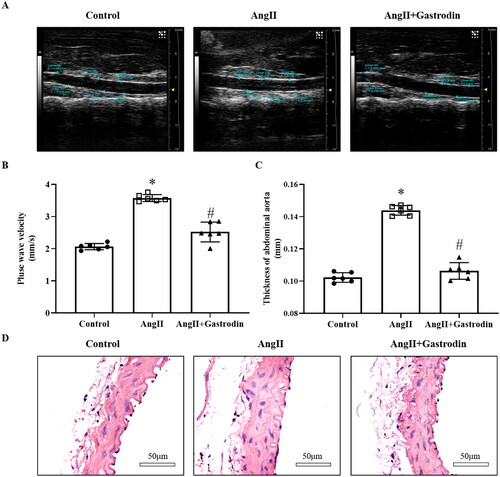 Figure 2. The effects of gastrodin on vascular function and pathological changes in the abdominal aorta of Ang II-infused mice. Ultrasound and haematoxylin and eosin (H&E) staining were performed to determine pulse wave velocity (PWV) and thickness of the abdominal aorta wall in each group. (A) PWV of the abdominal aorta. (B) Thickening of the abdominal aortic wall measured by ultrasound. (C) Representative ultrasonography images of the abdominal aorta. (D) Representative cross-sections of abdominal aortic tissues stained with H&E. Images were taken at a magnification of ×400. All values are presented as mean ± SD. *p < 0.05 Ang II vs. control group; #p < 0.05 Ang II + gastrodin vs. Ang II group.